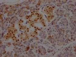 Islet-1 Antibody (1A1), Novus Biologicals:Antibodies:Primary Antibodies