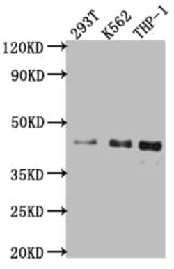 Islet-1 Antibody (1A1), Novus Biologicals:Antibodies:Primary Antibodies
