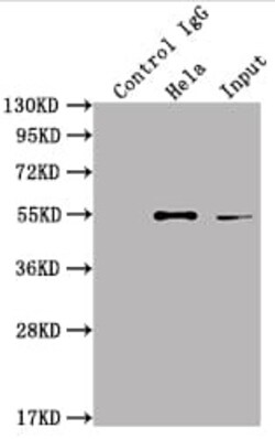 ILK Antibody (6A5), Novus Biologicals 100 &mu;L; Unconjugated:Antibodies,