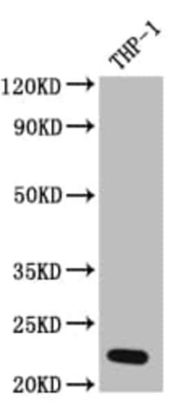 IL-23A/IL-23 P19 Antibody (1F6), Novus Biologicals:Antibodies:Primary Antibodies