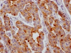 IGFBP-2 Antibody (7G11), Novus Biologicals:Antibodies:Primary Antibodies