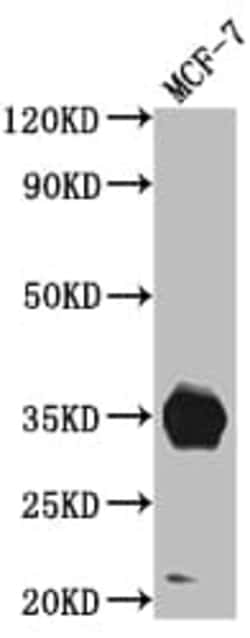 IGFBP-2 Antibody (7G11), Novus Biologicals:Antibodies:Primary Antibodies