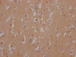 Huntingtin Antibody (6F2), Novus Biologicals:Antibodies:Primary Antibodies
