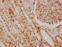 hnRNP C1 + C2 Antibody (9G1), Novus Biologicals 100 &mu;L; Unconjugated:Antibodies,