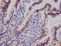 HMGCS2 Antibody (19C11), Novus Biologicals:Antibodies:Primary Antibodies