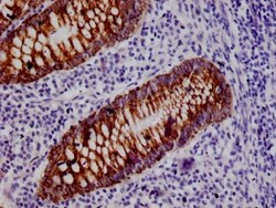 HMGCS2 Antibody (19C11), Novus Biologicals:Antibodies:Primary Antibodies