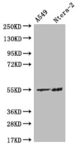 HMGCS2 Antibody (19C11), Novus Biologicals:Antibodies:Primary Antibodies