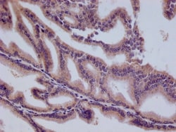 HMGCL Antibody (22H11), Novus Biologicals:Antibodies:Primary Antibodies