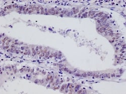 FIH-1/HIF-1AN Antibody (12F11), Novus Biologicals 50 &mu;L; Unconjugated:Antibodies,