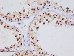 FIH-1/HIF-1AN Antibody (12F11), Novus Biologicals 50 &mu;L; Unconjugated:Antibodies,