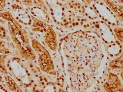 HDAC9 Antibody (1F2), Novus Biologicals:Antibodies:Primary Antibodies