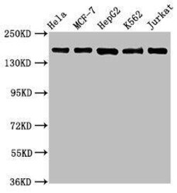 HDAC6 Antibody (2H12), Novus Biologicals:Antibodies:Primary Antibodies