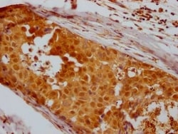 Histone Deacetylase 2/HDAC2 Antibody (9E9), Novus Biologicals:Antibodies:Primary