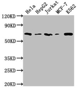 Histone Deacetylase 2/HDAC2 Antibody (9E9), Novus Biologicals:Antibodies:Primary