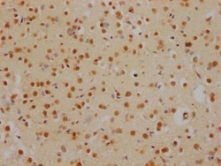 Histone Deacetylase 2/HDAC2 Antibody (9H4), Novus Biologicals:Antibodies:Primary