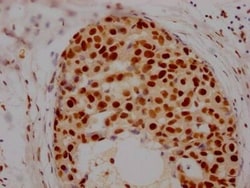 Histone Deacetylase 2/HDAC2 Antibody (9H4), Novus Biologicals:Antibodies:Primary