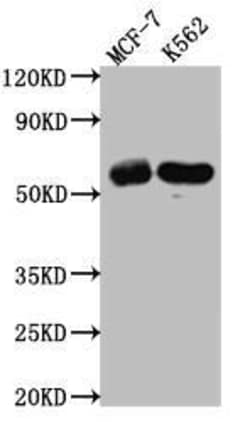 Histone Deacetylase 2/HDAC2 Antibody (9H4), Novus Biologicals:Antibodies:Primary