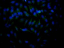 Histone Deacetylase 2/HDAC2 Antibody (9H4), Novus Biologicals:Antibodies:Primary