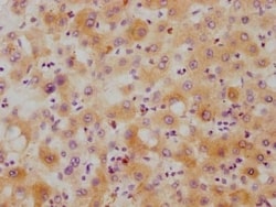 Hepcidin Antimicrobial Peptide Antibody (4C5), Novus Biologicals:Antibodies:Primary