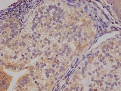 14-3-3 gamma Antibody (13C9), Novus Biologicals:Antibodies:Primary Antibodies