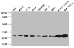 14-3-3 beta/alpha Antibody (6F6), Novus Biologicals:Antibodies:Primary