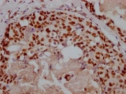 Ku80/XRCC5 Antibody (5G3), Novus Biologicals:Antibodies:Primary Antibodies