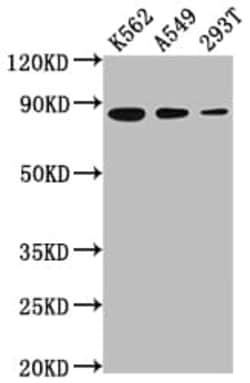 Ku80/XRCC5 Antibody (5G3), Novus Biologicals:Antibodies:Primary Antibodies