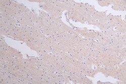 WNK1 Antibody (26G7), Novus Biologicals 100 &mu;L; Unconjugated:Antibodies,