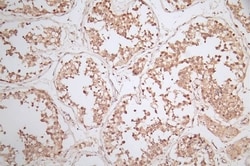 WDR5 Antibody (18D11), Novus Biologicals:Antibodies:Primary Antibodies