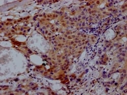 p97/VCP Antibody (5H12), Novus Biologicals 100 &mu;L; Unconjugated:Antibodies,