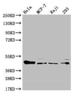 ULBP-1 Antibody (13C8), Novus Biologicals 100 &mu;L; Unconjugated:Antibodies,