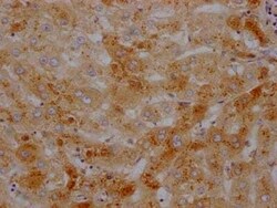Transthyretin/Prealbumin Antibody (3F6), Novus Biologicals 50 &mu;L; Unconjugated:Antibodies,