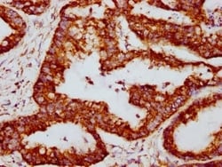 PBR Antibody (23G2), Novus Biologicals 50 &mu;L; Unconjugated:Antibodies,