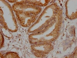TPT1/TCTP Antibody (10A9), Novus Biologicals:Antibodies:Primary Antibodies