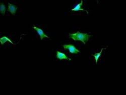 TPT1/TCTP Antibody (10A9), Novus Biologicals:Antibodies:Primary Antibodies
