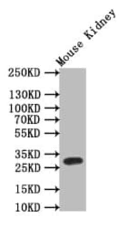 Tryptase beta-2/TPSB2 Antibody (9H6), Novus Biologicals:Antibodies:Primary