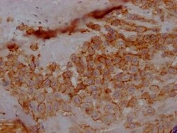 5T4 Antibody (6E9), Novus Biologicals:Antibodies:Primary Antibodies