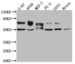 5T4 Antibody (6E9), Novus Biologicals:Antibodies:Primary Antibodies
