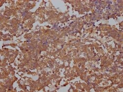 TOP2A Antibody (5B10), Novus Biologicals 100 &mu;L; Unconjugated:Antibodies,