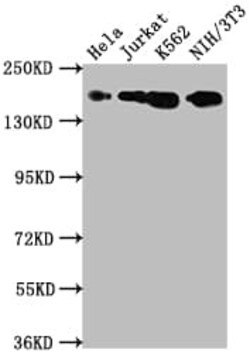 TOP2A Antibody (5B10), Novus Biologicals 100 &mu;L; Unconjugated:Antibodies,