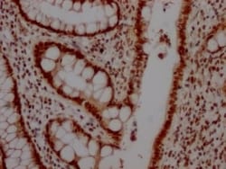 Topoisomerase I Antibody (6D8), Novus Biologicals:Antibodies:Primary Antibodies