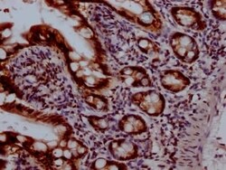 Topoisomerase I Antibody (6D8), Novus Biologicals:Antibodies:Primary Antibodies