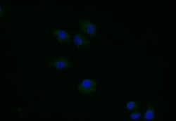 Thymidine Kinase 1 Antibody (6F6), Novus Biologicals 50 &mu;L; Unconjugated:Antibodies,