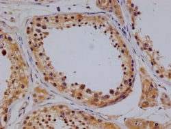 TBK1 Antibody (14D10), Novus Biologicals:Antibodies:Primary Antibodies