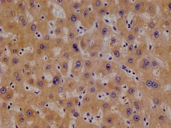 TBK1 Antibody (14D10), Novus Biologicals:Antibodies:Primary Antibodies