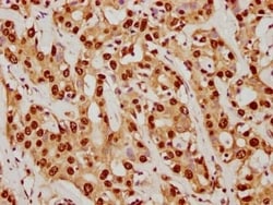 SUMO1 Antibody (5G3), Novus Biologicals:Antibodies:Primary Antibodies
