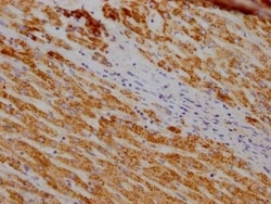 SOD2/Mn-SOD Antibody (10F6), Novus Biologicals 100 &mu;L; Unconjugated:Antibodies,