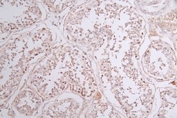 SOCS-7/Nck/NAP4 Antibody (23E4), Novus Biologicals 50 &mu;L; Unconjugated:Antibodies,