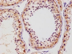 Glut3 Antibody (14B1), Novus Biologicals:Antibodies:Primary Antibodies