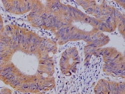 Glut3 Antibody (14B1), Novus Biologicals:Antibodies:Primary Antibodies